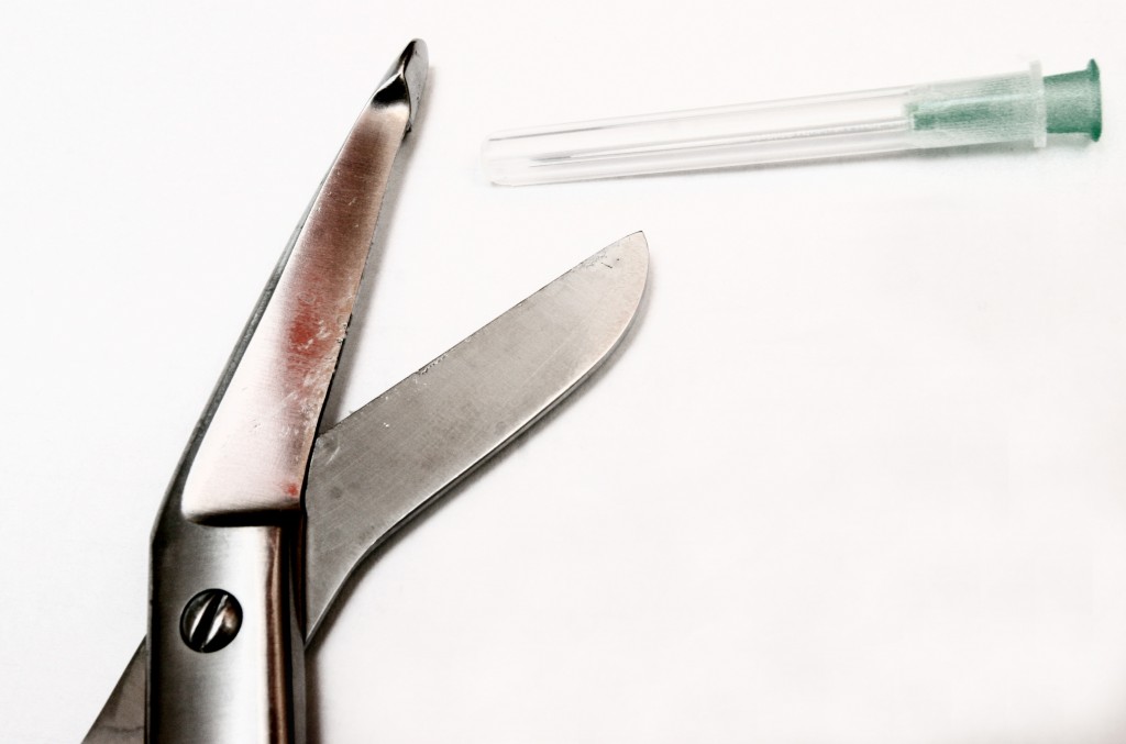 Face Transplant Update